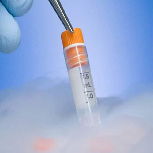 ivf